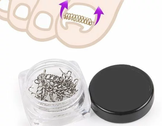 Beste deal ???? De Originele SoEASY Toepatch® - 12 Stuks - RVS Ingegroeide Teennagel Beugel - Ingegroeide Teennagel Corrector - Ingegroeide Teennagel - Teennagels - Vingernagel - Ingegroeide Teennagel Lifter - Ingegroeide - Kalknagel ???? 3 Beste deal ???? De Originele SoEASY Toepatch® - 12 Stuks - RVS Ingegroeide Teennagel Beugel - Ingegroeide Teennagel Corrector - Ingegroeide Teennagel - Teennagels - Vingernagel - Ingegroeide Teennagel Lifter - Ingegroeide - Kalknagel ???? - Afbeelding 3