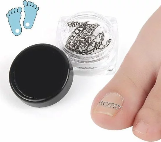 Beste deal ???? De Originele SoEASY Toepatch® - 12 Stuks - RVS Ingegroeide Teennagel Beugel - Ingegroeide Teennagel Corrector - Ingegroeide Teennagel - Teennagels - Vingernagel - Ingegroeide Teennagel Lifter - Ingegroeide - Kalknagel ???? 1 Beste deal ???? De Originele SoEASY Toepatch® - 12 Stuks - RVS Ingegroeide Teennagel Beugel - Ingegroeide Teennagel Corrector - Ingegroeide Teennagel - Teennagels - Vingernagel - Ingegroeide Teennagel Lifter - Ingegroeide - Kalknagel ????