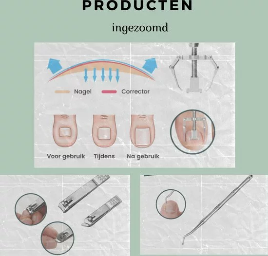 Beste recensies van ⭐ Coldcontour 16-delige Professionele Manicure Set En Pedicureset Voor Mannen En Vrouwen - Nagelverzorging En Voetverzorging- Gezichtsverzorging - Eplileerset - French Manicure Etui - Behandeling Nagels En Huid - Cadeau Tip Geschenkset- Nagelschaar Nagelvijl ???? 2 Beste recensies van ⭐ Coldcontour 16-delige Professionele Manicure Set En Pedicureset Voor Mannen En Vrouwen - Nagelverzorging En Voetverzorging- Gezichtsverzorging - Eplileerset - French Manicure Etui - Behandeling Nagels En Huid - Cadeau Tip Geschenkset- Nagelschaar Nagelvijl ???? - Afbeelding 2