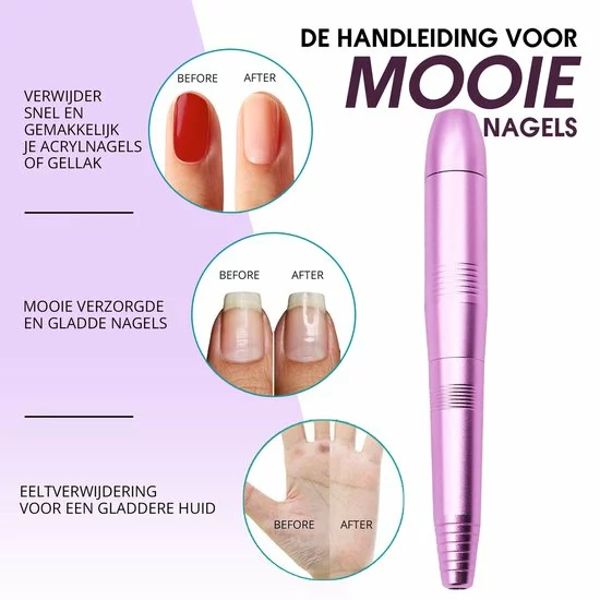 Aanbiedingen ???? Merkloos La Liva Elektrische Nagelvijl - Nagelfrees - Inclusief Extra Schuurrolletjes Keramisch Bitje En Nagelborstel - Manicure Set - Gellak ???? 4 Aanbiedingen ???? Merkloos La Liva Elektrische Nagelvijl - Nagelfrees - Inclusief Extra Schuurrolletjes Keramisch Bitje En Nagelborstel - Manicure Set - Gellak ???? - Afbeelding 4
