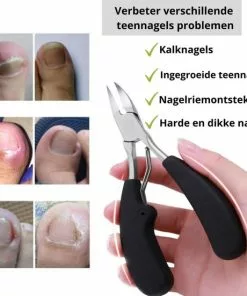 Gloednieuw ⌛ Skeraxo Professionele Kalknagel Schaar - Ingegroeide Teennagel - Nageltang Groot -Nagelschaar Voor Harde Nagels ???? -Jean Paul Gaultier Shop 550x551 16