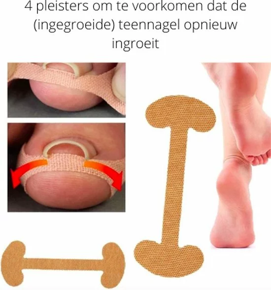 Top 10 ???? Wanties Ingegroeide Teennagel Complete 5-in 1 Set | Gereedschap Om Ingegroeide Nagels Te Verhelpen + Nageltang Nagelknipper | Nagellifter / Corrector Pleister | Kalknagel Kalknagels Nagellifter Lifter Pedicure | Nagelbeugel Nagelbeugeltjes ???? 3 Top 10 ???? Wanties Ingegroeide Teennagel Complete 5-in 1 Set | Gereedschap Om Ingegroeide Nagels Te Verhelpen + Nageltang Nagelknipper | Nagellifter / Corrector Pleister | Kalknagel Kalknagels Nagellifter Lifter Pedicure | Nagelbeugel Nagelbeugeltjes ???? - Afbeelding 3