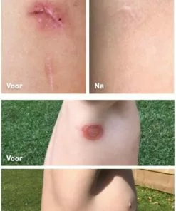 Nieuw ???? Staudt Wondzalf 20 Ml ???? 6 Nieuw ???? Staudt Wondzalf 20 Ml ???? -Jean Paul Gaultier Shop 550x817 2