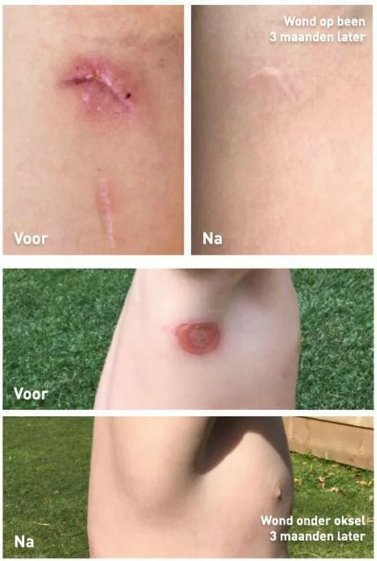 Nieuw ???? Staudt Wondzalf 20 Ml ???? 3 Nieuw ???? Staudt Wondzalf 20 Ml ???? - Afbeelding 3